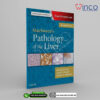 MacSween’s Pathology of the Liver, 7th Edition