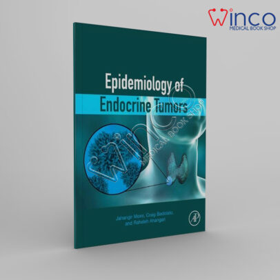 Epidemiology Of Endocrine Tumors