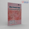 Dermoscopy In General Dermatology Winco Online Medical Book.jpg