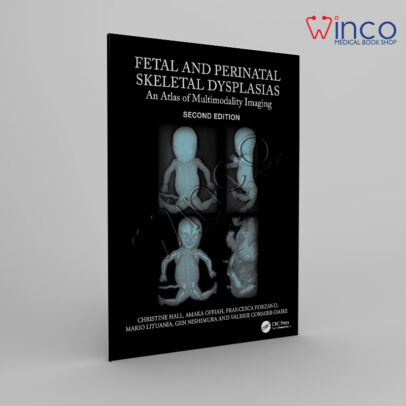 Fetal and Perinatal Skeletal Dysplasias