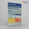 Color Atlas Of Dental Medicine: Periodontology 3rd Edition