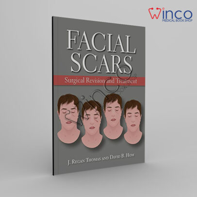 Facial Scars: Surgical Revision And Treatment