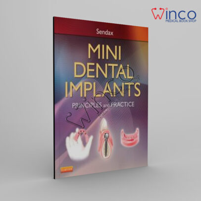 Mini Dental Implants: Principles And Practice