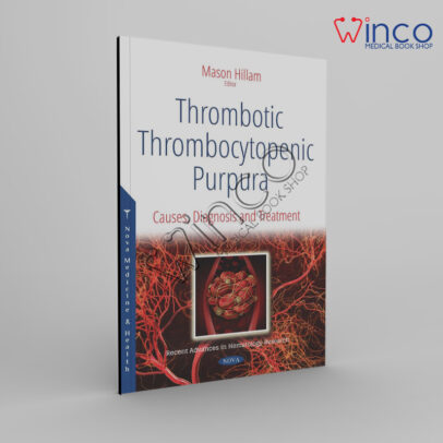 Thrombotic Thrombocytopenic Purpura: Causes, Diagnosis And Treatment
