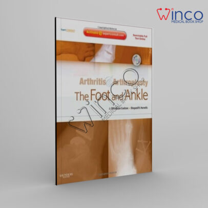 Arthritis and Arthroplasty: The Foot and Ankle