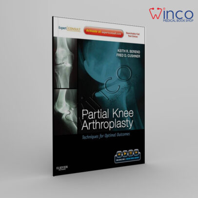 Partial Knee Arthroplasty: Techniques for Optimal Outcomes