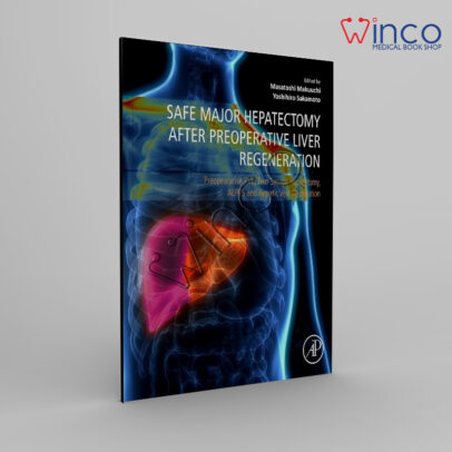 Safe Major Hepatectomy after Preoperative Liver Regeneration: Preopearative PVE, Two-Satage Hepatetomy, ALPPS and Hepatic Vein Deprivation 1st Edition