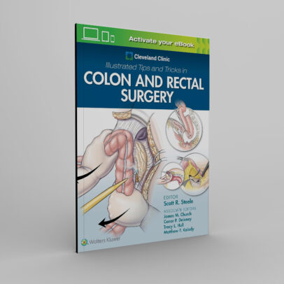 Cleveland Clinic Illustrated Tips and Tricks in Colon and Rectal Surgery 1st Edition