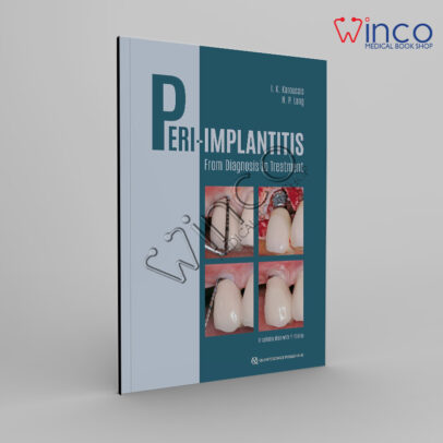 Peri-Implantitis: From Diagnosis to Treatment