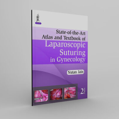 State-of-the-Art Atlas and Textbook of Laparoscopic Suturing in Gynecology 2nd Edition, Kindle Edition