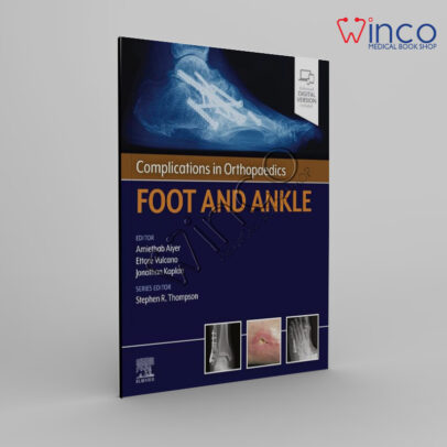 Complications in Orthopaedics Series Foot and Ankle - Ebook Kindle Edition
