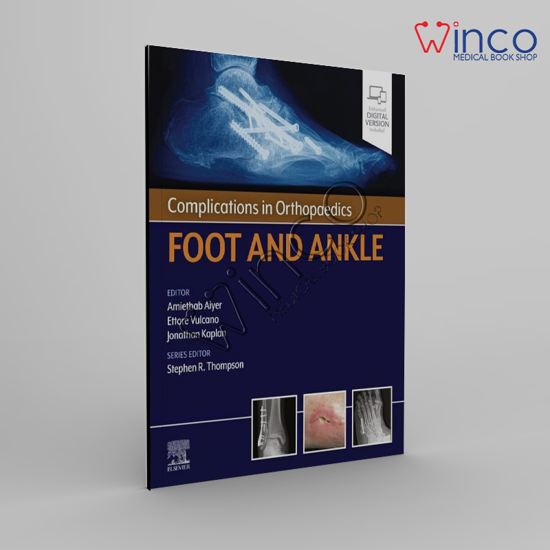 Complications in Orthopaedics Series Foot and Ankle - Ebook Kindle Edition