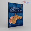 Pancreatic Cystic Lesions: A Multidisciplinary Approach, 1st Edition