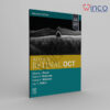Atlas of Retinal OCT E-Book: Optical Coherence Tomography
