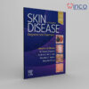 Skin Disease: Diagnosis and Treatment