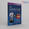 The Adult Hip