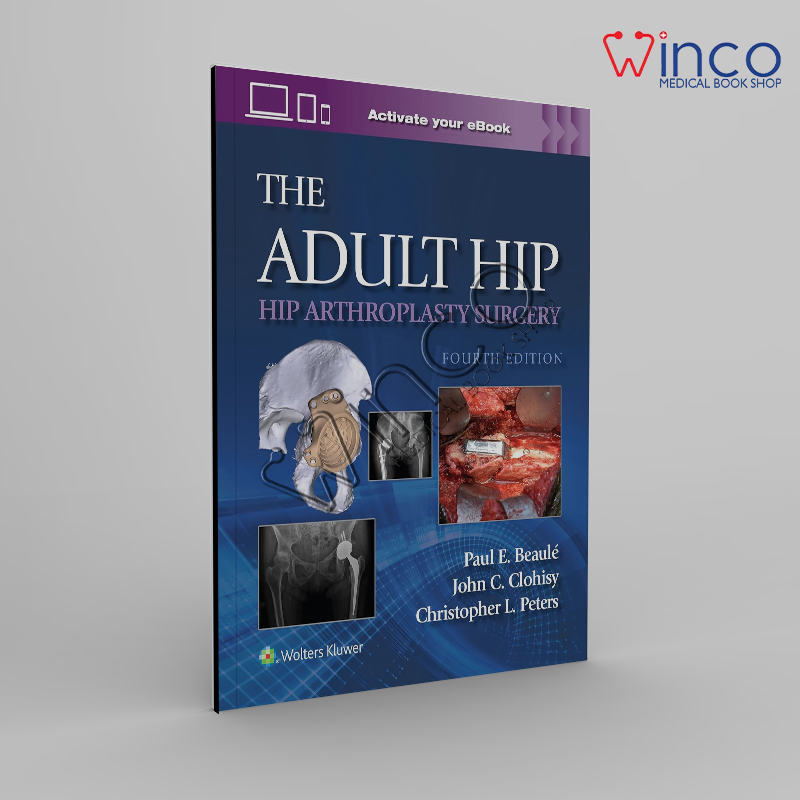 The Adult Hip