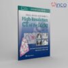 Webb, Müller and Naidich’s High-Resolution CT of the Lung, 6th edition