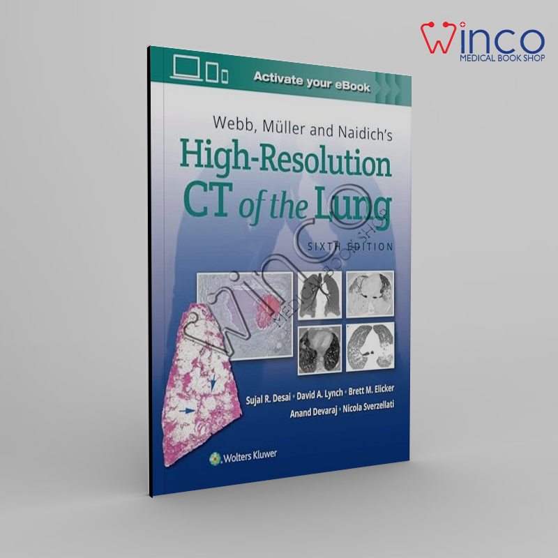 Webb, Müller and Naidich’s High-Resolution CT of the Lung, 6th edition
