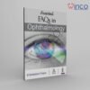 Aravind FAQs in Ophthalmology