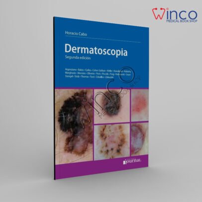 Dermatoscopia