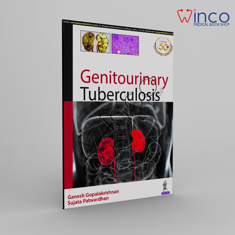 Genitourinary Tuberculosis